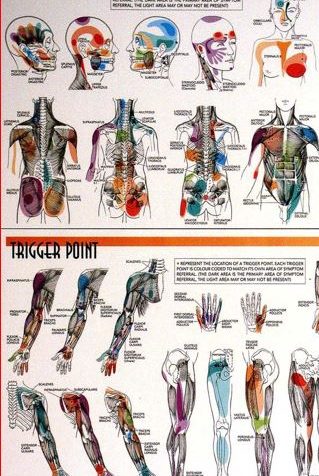 Cartographies des douleurs référées musculaires